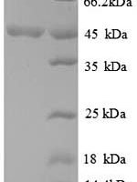 Sporosarcina ureae Phenylalanine dehydrogenase (pdh) Recombinant Protein - BioCrest Sci