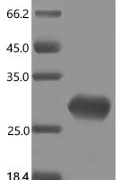 Human Complement factor H-related protein 5 (CFHR5), partial Recombinant Protein - BioCrest Sci