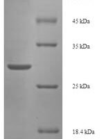 Salmonella typhimurium Invasion protein iagB (iagB) Recombinant Protein - BioCrest Sci