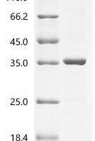 Campylobacter jejuni subsp. jejuni serotype O:2 Cytolethal distending toxin subunit A (cdtA) Recombinant Protein - BioCrest Sci