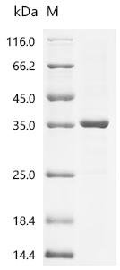 Campylobacter jejuni subsp. jejuni serotype O:2 Cytolethal distending toxin subunit A (cdtA) Recombinant Protein, Campylobacter jejuni subsp. jejuni serotype O:2 (strain ATCC 700819 / NCTC 11168), E.coli, C-terminal 6xHis-tagged, 34.5 kDa, purity >≥ 85% as determined by SDS-PAGE.