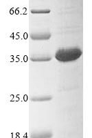 Human DDB1- and CUL4-associated factor 16 (DCAF16) Recombinant Protein - BioCrest Sci