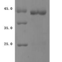 Human Bromodomain-containing protein 4 (BRD4), partial Recombinant Protein, N-His-GST - BioCrest Sci