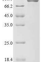 Human Procollagen-lysine,2-oxoglutarate 5-dioxygenase 2 (PLOD2) Recombinant Protein - BioCrest Sci