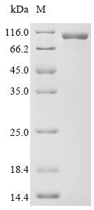 Human Procollagen-lysine,2-oxoglutarate 5-dioxygenase 2 (PLOD2) Recombinant Protein, Homo sapiens (Human), Mammalian cell, C-terminal 10xHis-tagged, 83.4 kDa, purity >≥ 95% as determined by SDS-PAGE.