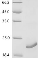Human papillomavirus type 6 Protein E7 (E7) Recombinant Protein - BioCrest Sci