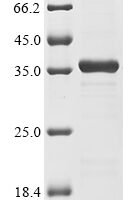 Human Double-stranded RNA-specific adenosine deaminase (ADAR), partial Recombinant Protein, N-His-SUMO - BioCrest Sci