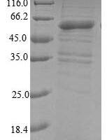 Human Probable E3 ubiquitin-protein ligase makorin-3 (MKRN3) Recombinant Protein - BioCrest Sci