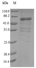 Human Probable E3 ubiquitin-protein ligase makorin-3 (MKRN3) Recombinant Protein, Homo sapiens (Human), E.coli, N-terminal 10xHis-tagged and C-terminal Myc-tagged, 60.6 kDa, purity >≥ 90% as determined by SDS-PAGE.