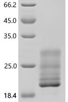 Macaca fascicularis Alpha-synuclein (SNCA) Recombinant Protein - BioCrest Sci