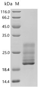 Macaca fascicularis Alpha-synuclein (SNCA) Recombinant Protein, Mammalian cell, C-terminal 10xHis-tagged, 15.8 kDa, purity >≥ 95% as determined by SDS-PAGE.