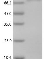 Mouse Isthmin-1 (Ism1) Recombinant Protein, C-His - BioCrest Sci