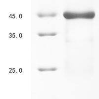 Human Group 10 secretory phospholipase A2 (PLA2G10) Recombinant Protein - BioCrest Sci