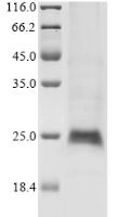 Human Cytokine receptor common subunit gamma (IL2RG) (N75Q), partial Recombinant Protein, C-His - BioCrest Sci