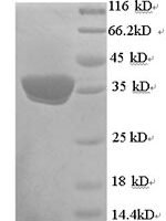 Human Mitochondrial brown fat uncoupling protein 1 (UCP1) Recombinant Protein, N-His - BioCrest Sci