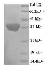 Human Mitochondrial brown fat uncoupling protein 1 (UCP1) Recombinant Protein, N-His, Homo sapiens (Human), Yeast, N-terminal 6xHis-tagged, 34.9 kDa, purity >≥ 90% as determined by SDS-PAGE.