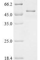 Human Cyclin-Y-like protein 1 (CCNYL1) Recombinant Protein - BioCrest Sci