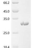 Newcastle disease virus RNA-directed RNA polymerase L (L), partial Recombinant Protein, N-His - BioCrest Sci