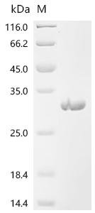 Newcastle disease virus RNA-directed RNA polymerase L (L), partial Recombinant Protein, N-His, Newcastle disease virus (strain Chicken/United States/B1/48) (NDV), E.coli, N-terminal 6xHis-tagged, 30.7 kDa, purity >≥ 95% as determined by SDS-PAGE.