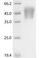 Pig Growth hormone receptor (GHR), partial Recombinant Protein, C-10His - BioCrest Sci