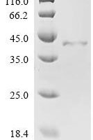 Human A disintegrin and metalloproteinase with thrombospondin motifs 12 (ADAMTS12), partial Recombinant Protein - BioCrest Sci