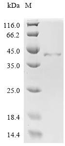 Human A disintegrin and metalloproteinase with thrombospondin motifs 12 (ADAMTS12), partial Recombinant Protein, Homo sapiens (Human), E.coli, C-terminal 6xHis-tagged, 40.4 kDa, purity >≥ 95% as determined by SDS-PAGE.