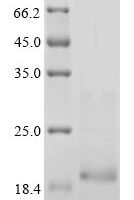 Human Neurotrophin-3 (NTF3) Recombinant Protein, N-10His/C-Myc, aa 139–257, Baculovirus - BioCrest Sci