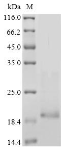 Human Neurotrophin-3 (NTF3) Recombinant Protein, N-10His/C-Myc, aa 139–257, Baculovirus, Homo sapiens (Human), Baculovirus, N-terminal 10xHis-tagged and C-terminal Myc-tagged, 17.5 kDa, purity >≥ 85% as determined by SDS-PAGE.
