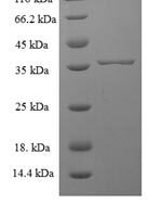 Human Sorting nexin-24 (SNX24) Recombinant Protein - BioCrest Sci