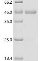 Salmonella typhi Secreted effector protein pipB2 (pipB2) Recombinant Protein - BioCrest Sci