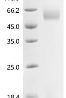 Human HERV-H LTR-associating protein 2 (HHLA2), partial Recombinant Protein - BioCrest Sci
