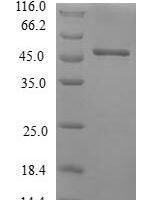 Human Beta-crystallin S (CRYGS Recombinant Protein - BioCrest Sci