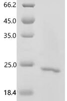 Human Secretory phospholipase A2 receptor (PLA2R1), partial Recombinant Protein, C-His - BioCrest Sci