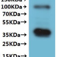 Human Membrane protein MLC1 (MLC1)-VLPs Recombinant Protein - BioCrest Sci