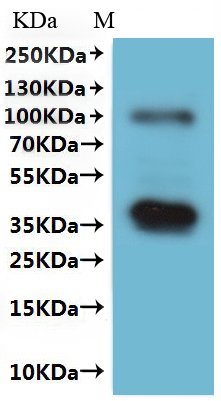 Human Membrane protein MLC1 (MLC1)-VLPs Recombinant Protein, Homo sapiens (Human), Mammalian cell, C-terminal 10xHis-tagged, 42.6 kDa, purity >≥ 95% as determined by SEC-HPLC.