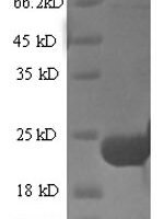 Erythrina caffra Trypsin inhibitor DE-3 Recombinant Protein - BioCrest Sci