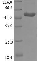 Lactobacillus paracasei D-2-hydroxyisocaproate dehydrogenase Recombinant Protein - BioCrest Sci