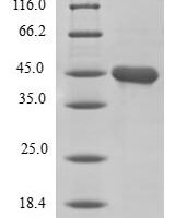 Human LIM domain transcription factor LMO4 (LMO4) Recombinant Protein - BioCrest Sci