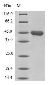 Human LIM domain transcription factor LMO4 (LMO4) Recombinant Protein, Homo sapiens (Human), E.coli, N-terminal GST-tagged, 45.0 kDa, purity >≥ 90% as determined by SDS-PAGE.