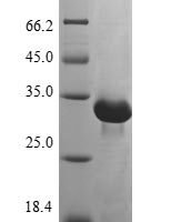 Human Thymidine kinase 2, mitochondrial (TK2) Recombinant Protein - BioCrest Sci