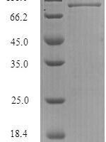 Influenza B virus Nucleoprotein (NP) Recombinant Protein, N-His-SUMO, aa 1–560, strain B/Singapore/222/1979 - BioCrest Sci