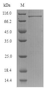 Influenza B virus Nucleoprotein (NP) Recombinant Protein, N-His-SUMO, aa 1–560, strain B/Singapore/222/1979, Influenza B virus (strain B/Singapore/222/1979), E.coli, N-terminal 6xHis-SUMO-tagged, 77.6 kDa, purity >≥ 90% as determined by SDS-PAGE.