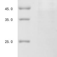 Human Catenin beta-1 (CTNNB1) Recombinant Protein, N-His, aa 2–781, E.coli - BioCrest Sci