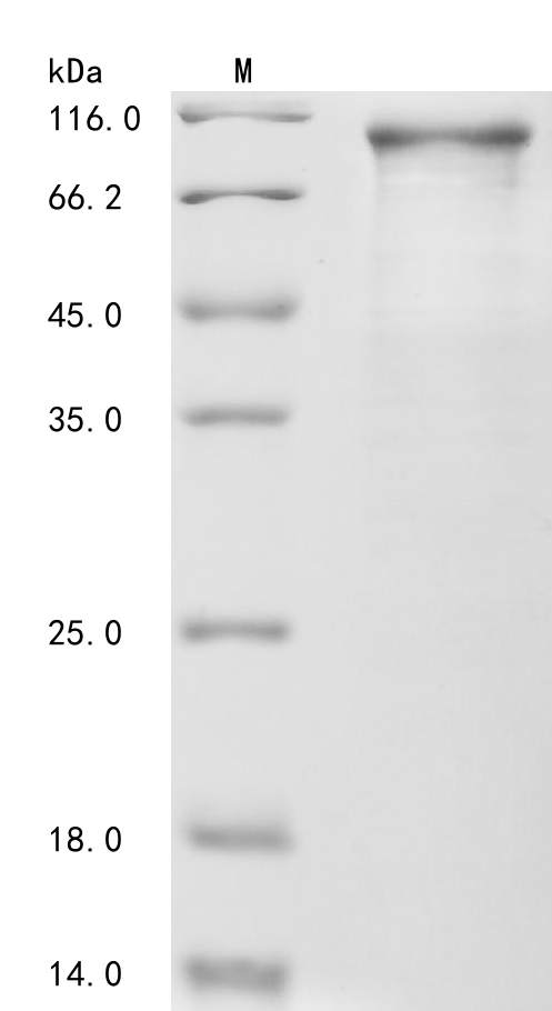 Human Catenin beta-1 (CTNNB1) Recombinant Protein, N-His, aa 2–781, E.coli, Homo sapiens (Human), E.coli, N-terminal 6xHis-tagged, 90.9 kDa, purity >≥ 85% as determined by SDS-PAGE.