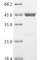 Mouse Adipocyte plasma membrane-associated protein (Apmap), partial Recombinant Protein - BioCrest Sci