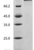 Mouse Receptor tyrosine-protein kinase erbB-3 (Erbb3), partial Recombinant Protein - BioCrest Sci