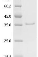 Saccharomyces cerevisiae Meiotic recombination protein DMC1 (DMC1) Recombinant Protein, C-His, aa 1–334, Yeast - BioCrest Sci