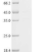 Rabies virus Glycoprotein (G), partial, Biotinylated Recombinant Protein - BioCrest Sci