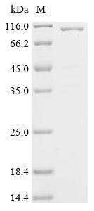 Rabies virus Glycoprotein (G), partial, Biotinylated Recombinant Protein, Rabies virus (strain HEP-Flury) (RABV), E.coli, N-terminal MBP-tagged and C-terminal 6xHis-Avi-tagged, 97.3 kDa, purity >≥ 90% as determined by SDS-PAGE.