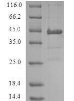 Human Low molecular weight phosphotyrosine protein phosphatase (ACP1) Recombinant Protein, N-GST - BioCrest Sci